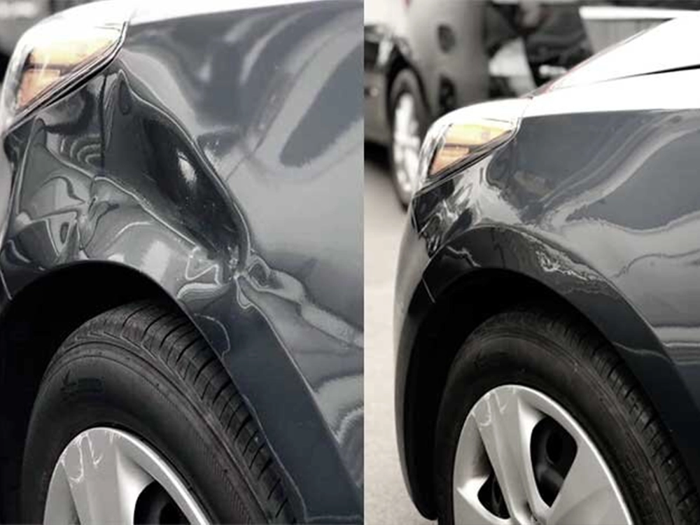 Dent Removal